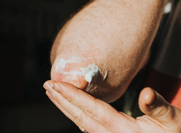 The Decade-by-Decade Skin Plan That Makes Wrinkle Prevention Feel Automatic